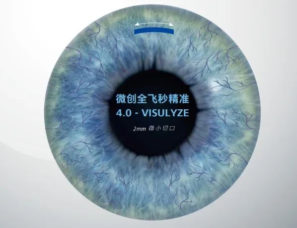 生活由我不由镜丨深度解析全飞秒有效4.0