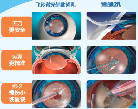 1+1>2，飞白+三焦晶体：解锁高清无镜体验