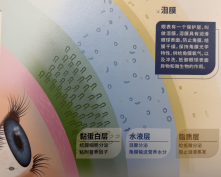 干眼不是 “缺水”：是泪膜三层都可能出问题